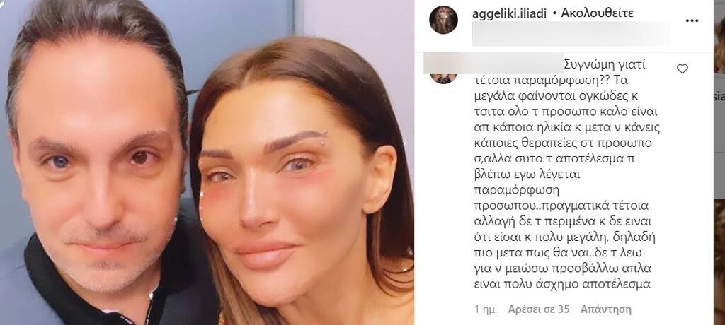 Το μήνυμα follower